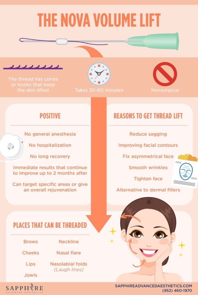 Sapphire_Aug2016_NovaLiftInfographic-01