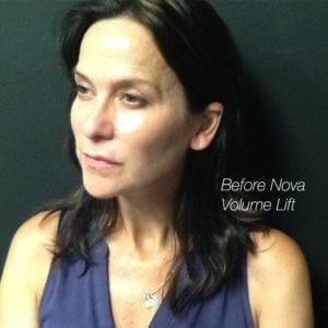 Sapphire_BA_NovaLift1