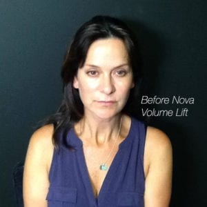 Sapphire_BA_NovaLift2