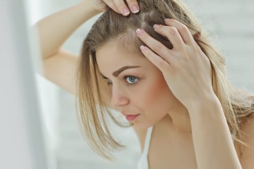 female hair loss patient