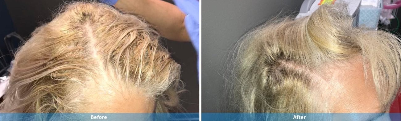 Main Gallery Image 16 | Hair Gallery