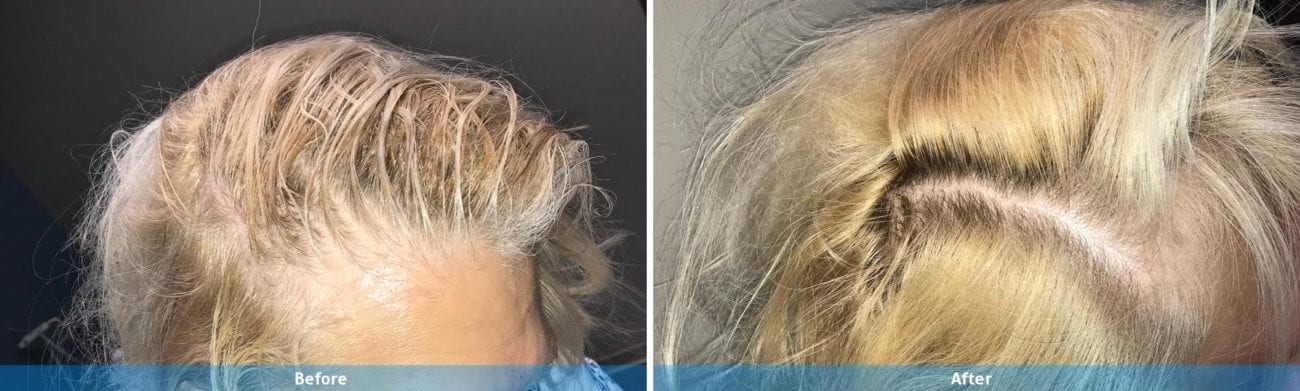 Main Gallery Image 17 | Hair Gallery