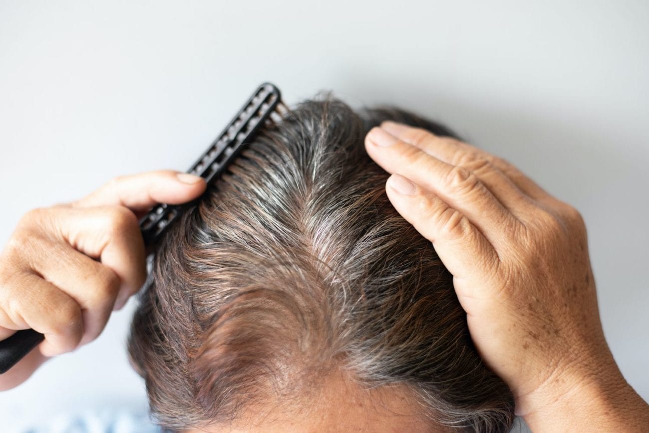 hair loss treatment plymouth mn