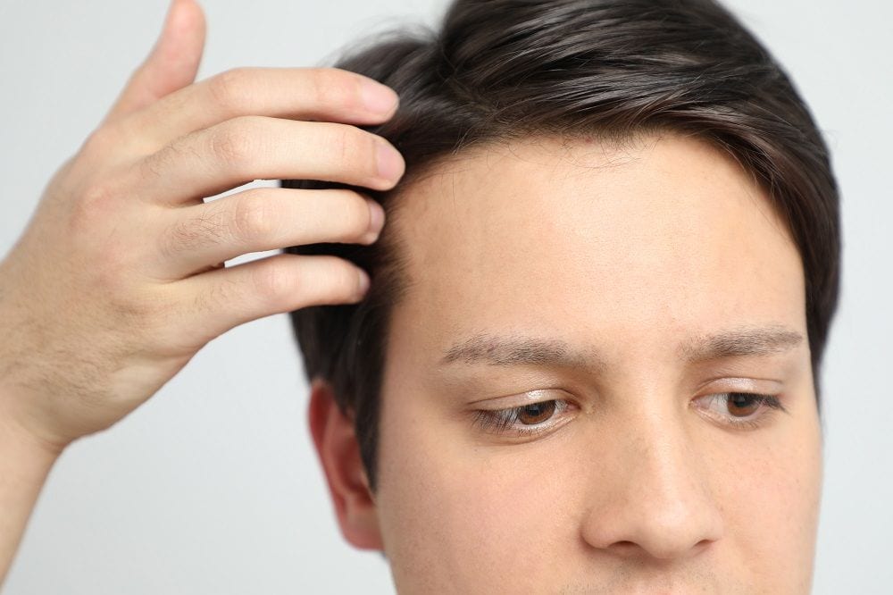 hair restoration benefits in Minneapolis Minnesota