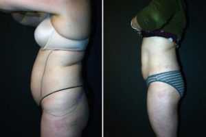 Main Gallery Image 39 | Body Gallery