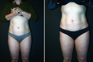 Main Gallery Image 41 | Body Gallery