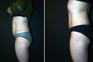 Main Gallery Image 42 | Body Gallery