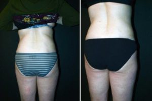 Main Gallery Image 43 | Body Gallery