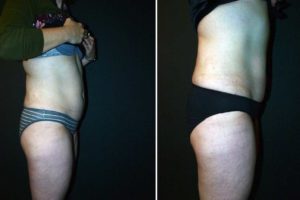 Main Gallery Image 44 | Body Gallery