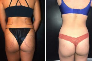 Main Gallery Image 45 | Body Gallery