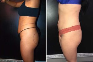 Main Gallery Image 47 | Body Gallery