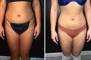 Main Gallery Image 48 | Body Gallery