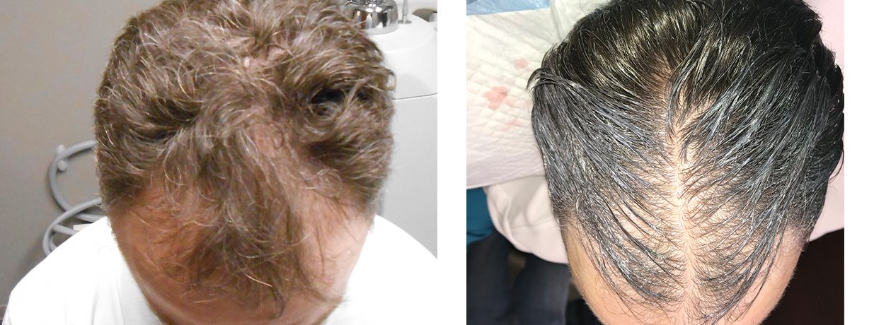 Main Gallery Image 10 | Hair Gallery