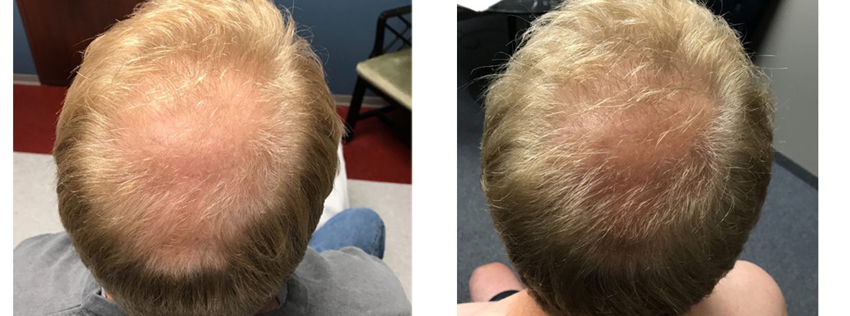 Hair Gallery | Sapphire Advanced Aesthetics Hair Gallery | Sapphire Advanced Aesthetics
