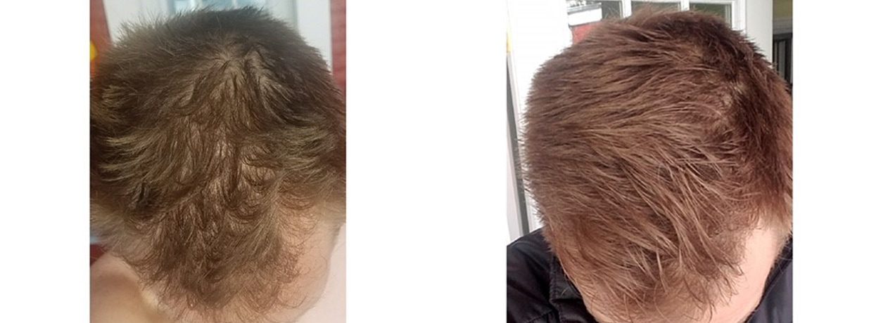 Hair Gallery | Sapphire Advanced Aesthetics Hair Gallery | Sapphire Advanced Aesthetics