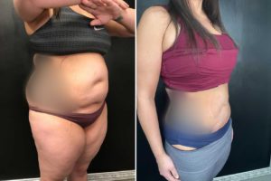 Main Gallery Image 3 | Body Gallery