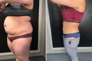 Main Gallery Image 5 | Body Gallery