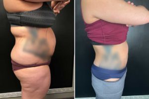 Main Gallery Image 4 | Body Gallery