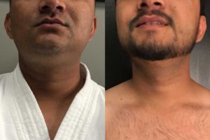 Main Gallery Image 10 | Body Gallery