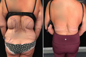 Main Gallery Image 6 | Body Gallery