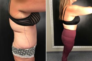 Main Gallery Image 7 | Body Gallery