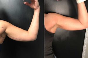 Main Gallery Image 8 | Body Gallery