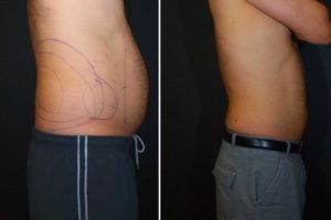 Main Gallery Image 15 | Body Gallery