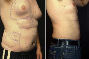 Main Gallery Image 16 | Body Gallery