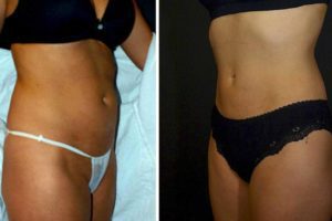 Main Gallery Image 17 | Body Gallery