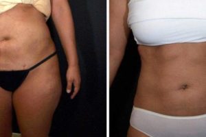 Main Gallery Image 18 | Body Gallery