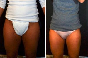 Main Gallery Image 20 | Body Gallery