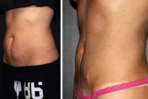 Main Gallery Image 21 | Body Gallery