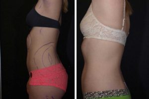 Main Gallery Image 22 | Body Gallery