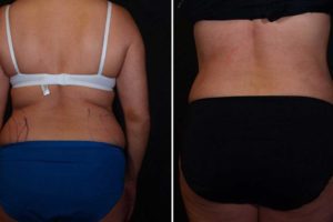 Main Gallery Image 23 | Body Gallery