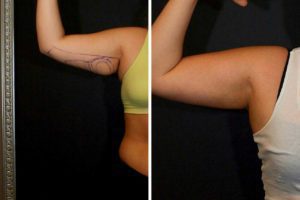 Main Gallery Image 24 | Body Gallery