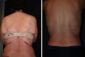 Main Gallery Image 12 | Body Gallery