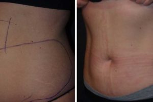 Main Gallery Image 14 | Body Gallery