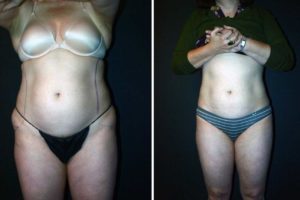 Main Gallery Image 33 | Body Gallery