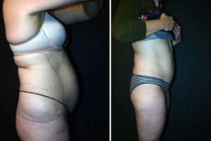 Main Gallery Image 34 | Body Gallery