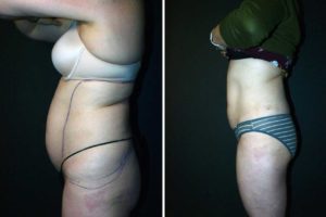 Main Gallery Image 35 | Body Gallery