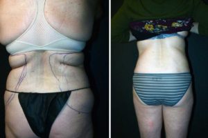 Main Gallery Image 36 | Body Gallery