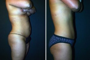 Main Gallery Image 27 | Body Gallery