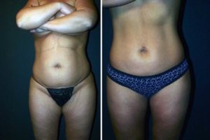 Main Gallery Image 25 | Body Gallery