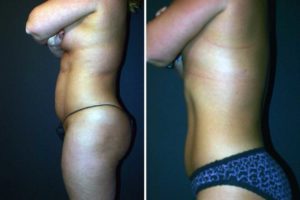 Main Gallery Image 28 | Body Gallery