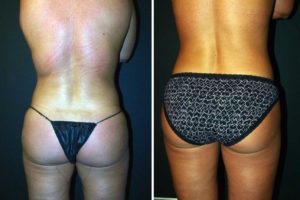 Main Gallery Image 26 | Body Gallery