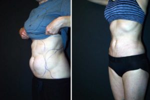 Main Gallery Image 29 | Body Gallery