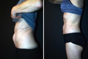 Main Gallery Image 30 | Body Gallery