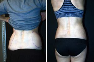 Main Gallery Image 31 | Body Gallery