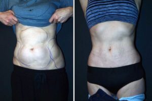 Main Gallery Image 32 | Body Gallery