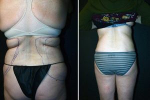 Main Gallery Image 38 | Body Gallery